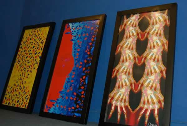 Arte & Artritis
